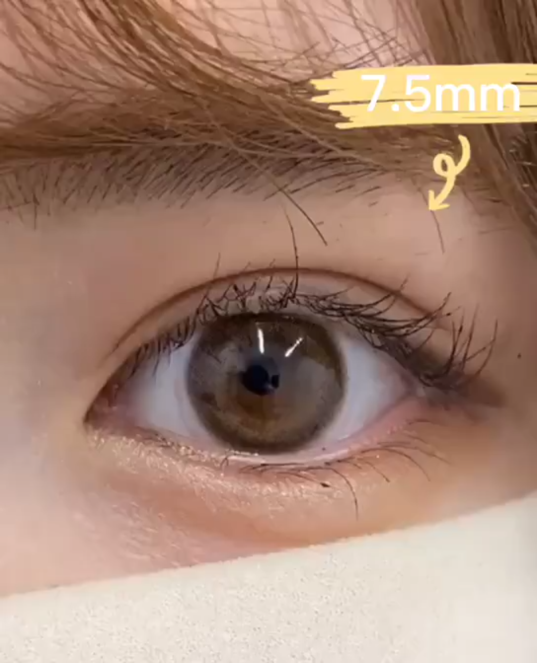 有姐妹问我8mm双眼皮宽度不会太假吗?_哔哩哔哩_bilibili