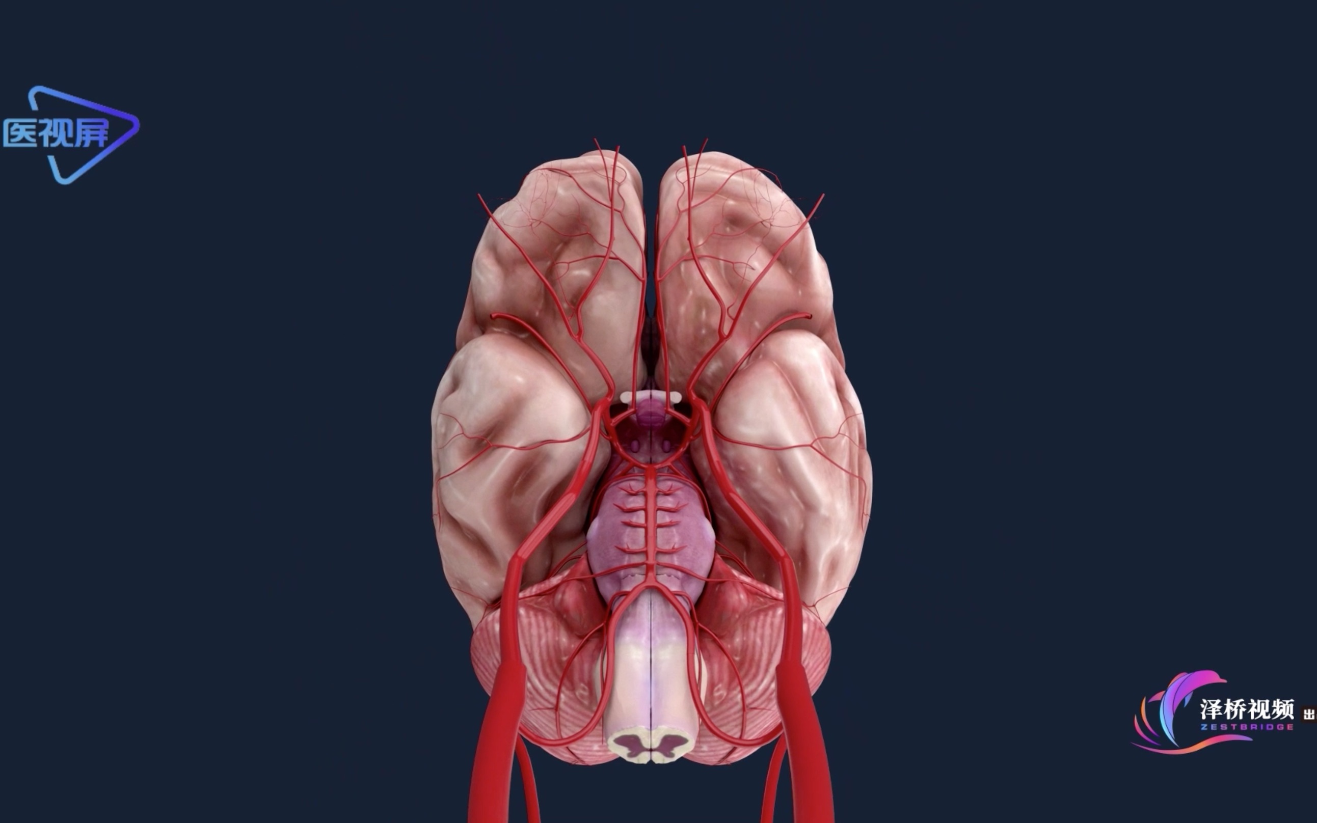大脑动脉环3d图图片