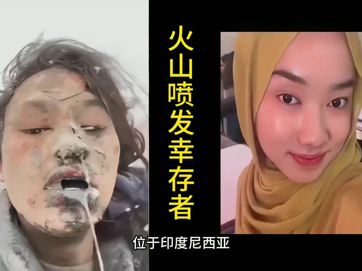印尼火山喷发，幸存者满脸是灰，对着镜头求救:妈妈，救救我