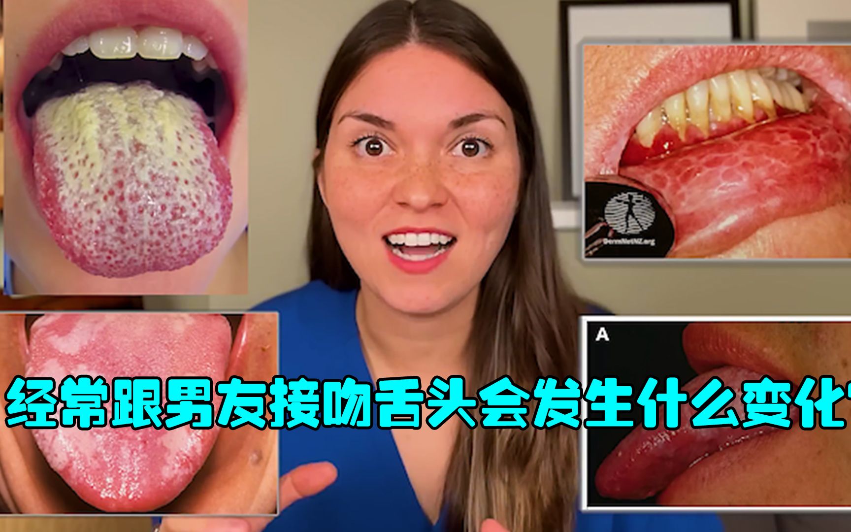 经常跟男友接吻舌头会发生什么变化?