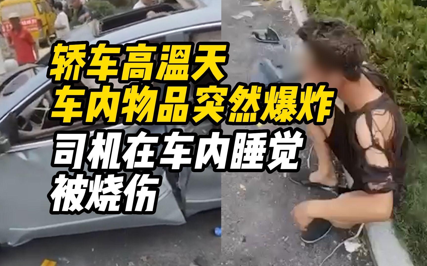 郑州一轿车内物品高温天突然爆炸:司机在车内睡觉被烧伤哔哩哔哩bilibili