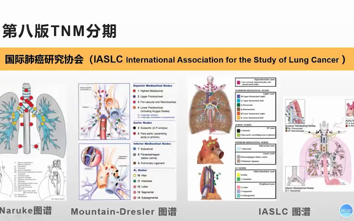 2.肺癌淋巴结分区胸部肿瘤影像系列1哔哩哔哩bilibili