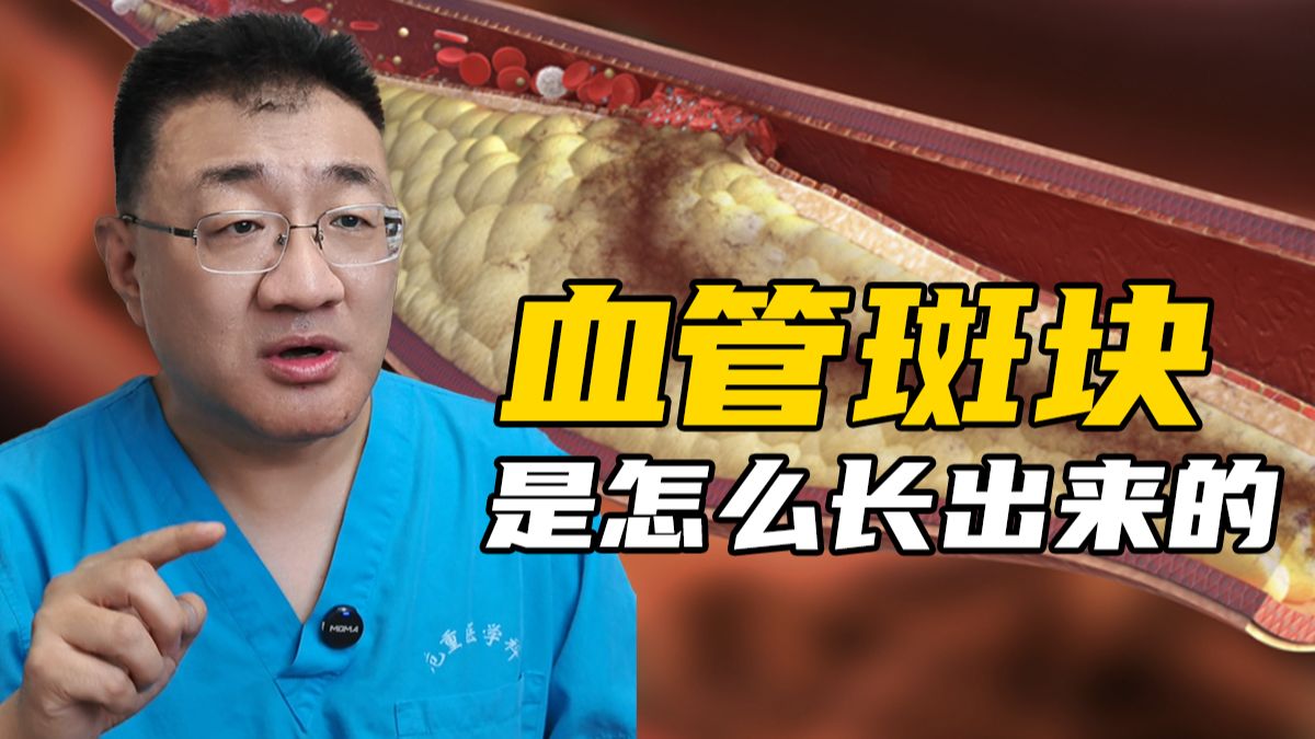 血管里的斑块到底是怎么长出来的 ？