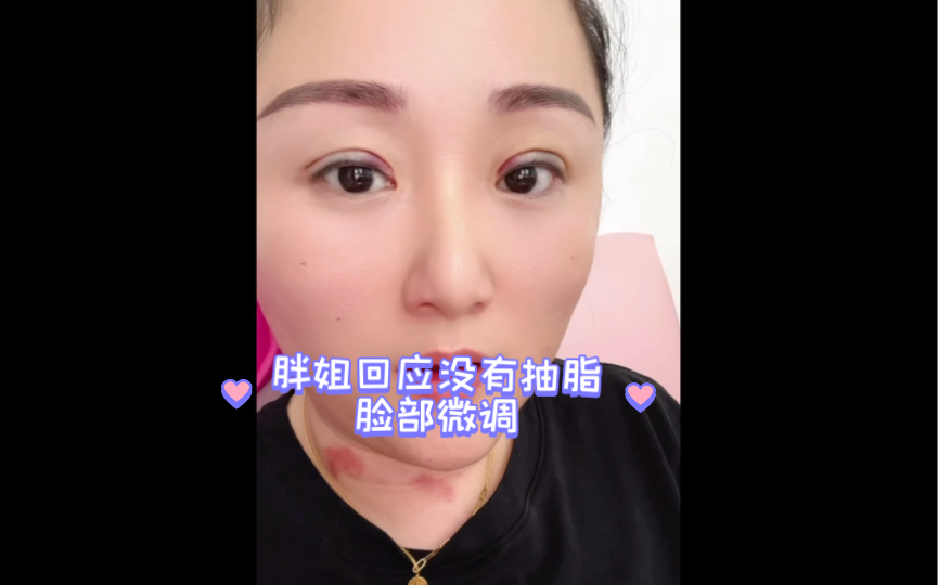 北京胖姐姐 ks直播回放 回应没有抽脂 脸部微调哔哩哔哩bilibili