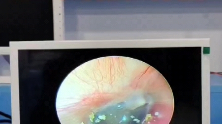 可视掏耳朵可视掏耳镜摆摊采耳仪采耳视镜采耳内窥镜可视掏耳勺专用