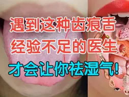 Download Video: 遇到这种齿痕舌，只有经验不足的医生，才会让你祛湿气！