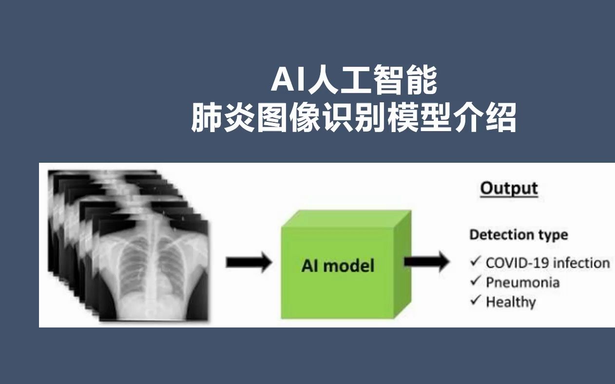 AI人工智能肺炎图像识别模型生物医药企业科研和商业模型应用哔哩哔哩bilibili