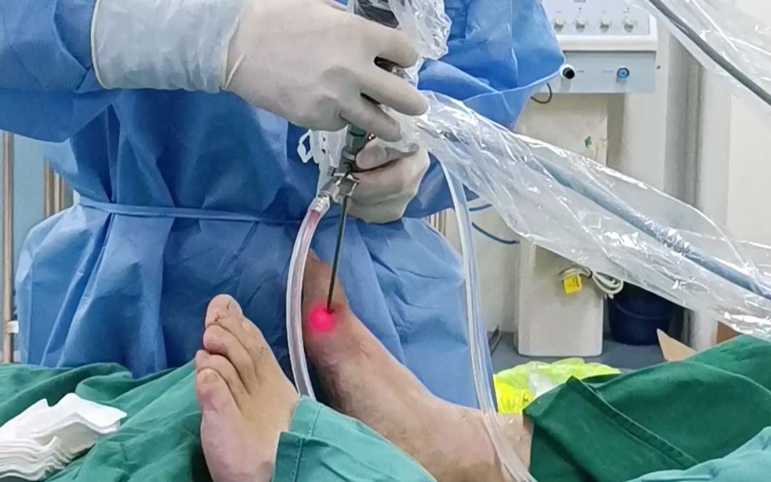 关于痛风石,针刀镜有什么好处呢?