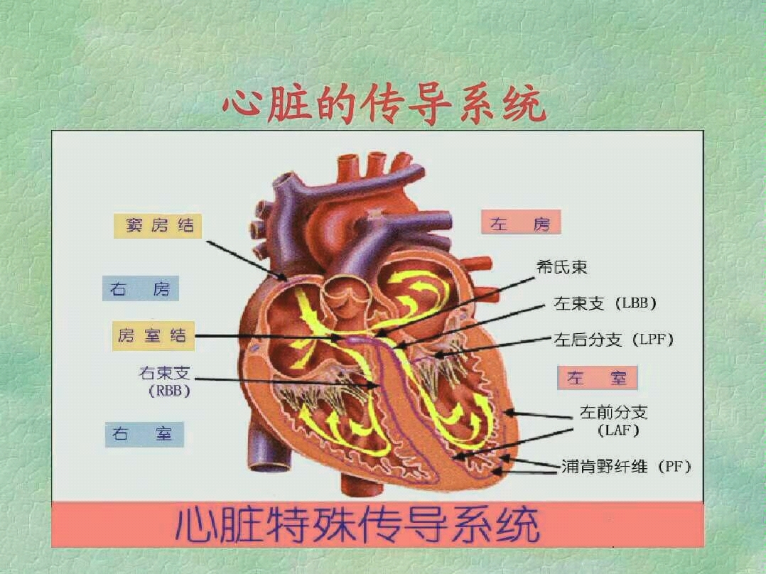 各种异常心电图及其特点,医学生必备技能.哔哩哔哩bilibili