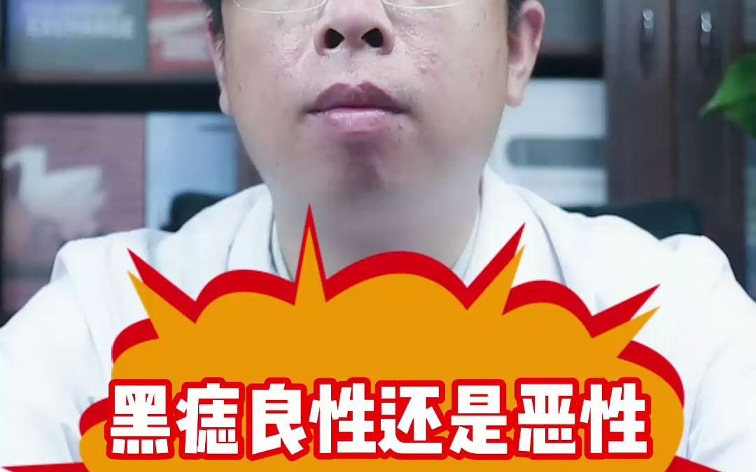 黑痣良性还是恶性 4个方法教你辨别哔哩哔哩bilibili