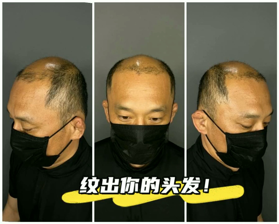 纹发##福建顶密时尚纹发#纹发后的前后