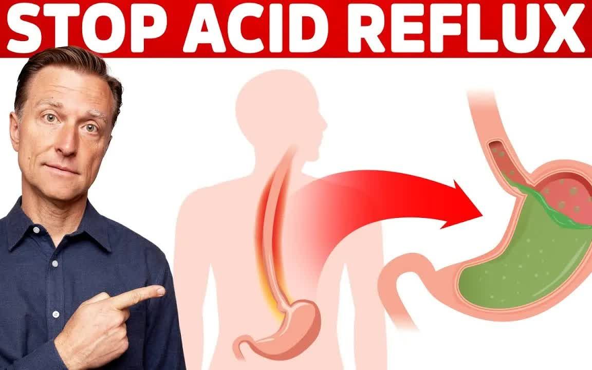 [图]如何立即停止反酸 How to STOP Acid Reflux Instantly