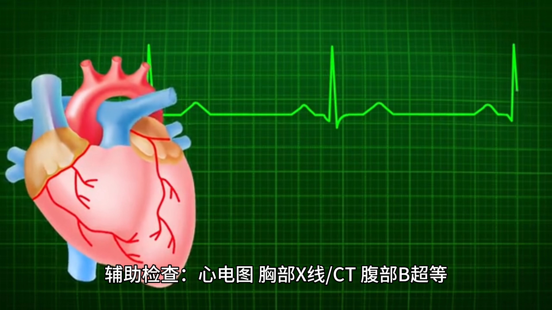 因为心电图被拒入职图片