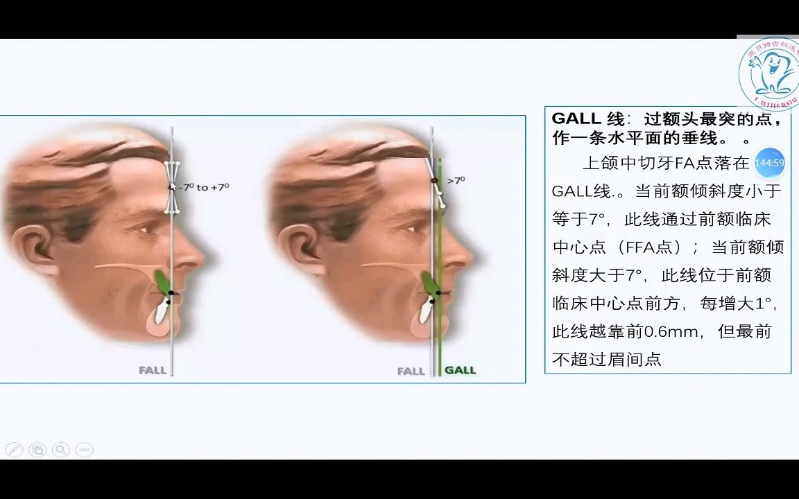 10 化繁为简——口腔正畸实用头影测量(二)哔哩哔哩bilibili