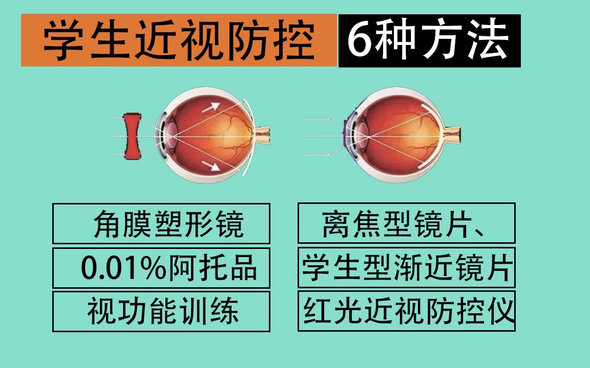 学生近视防控6种方法分析,蔡司成长乐、豪雅新乐学、OK角膜塑形镜、学生镜片、视功能训练、红光近视治疗哔哩哔哩bilibili