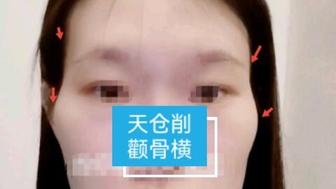 女性有此 天仓塌陷且颧骨横 多性格挑剔 不容易相处 要注重家庭 哔哩哔哩