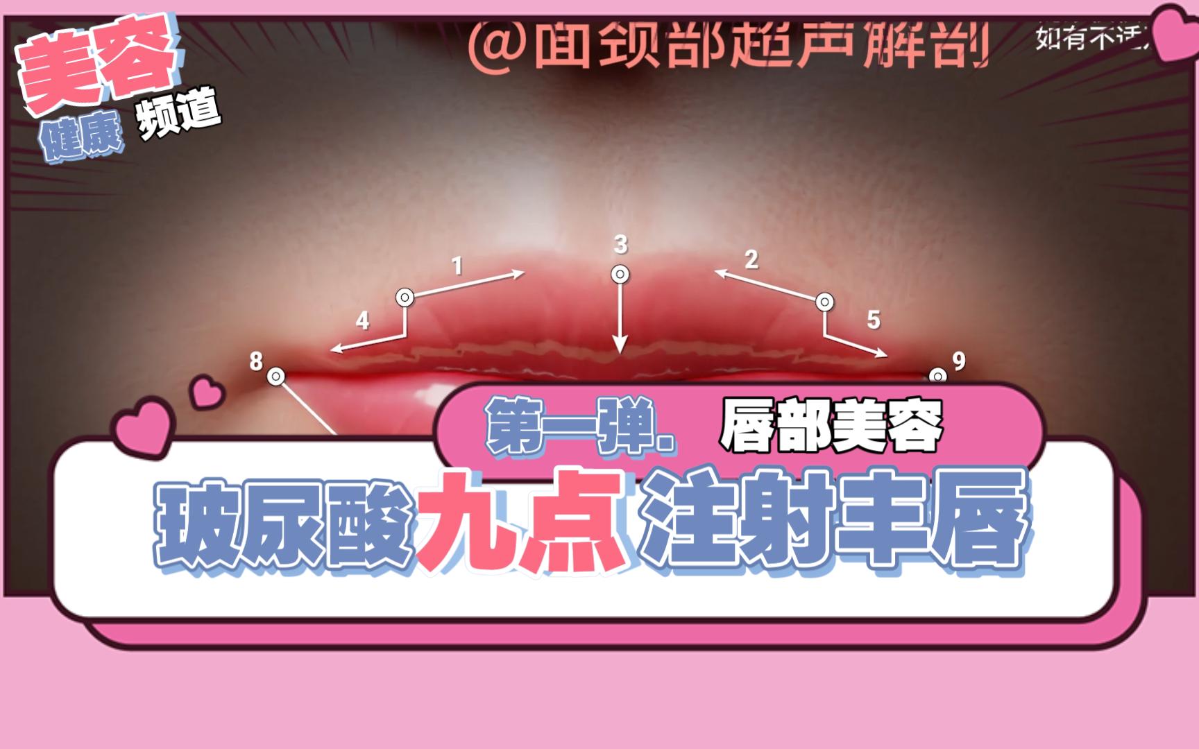 【填充注射学习】透明质酸9点注射丰唇技术——2024年最新发表文献