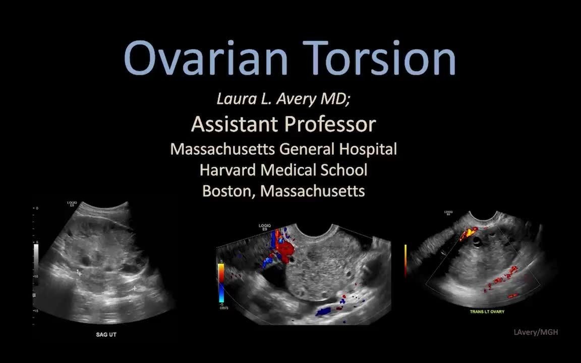 6127AveryOvarian Torsion哔哩哔哩bilibili