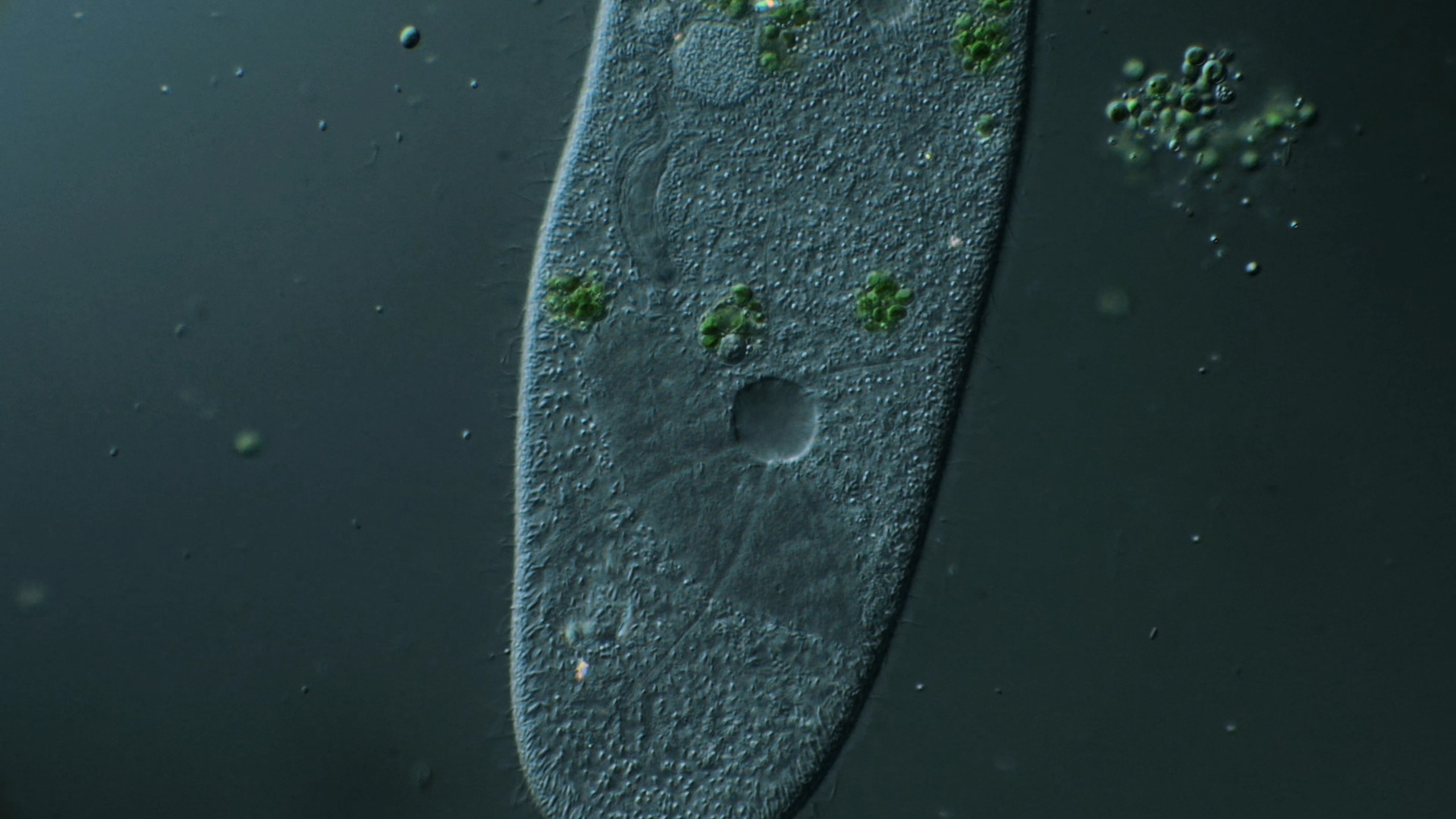 被压瘪的草履虫
