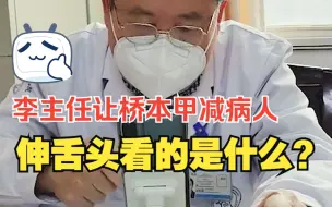 Tải video: 李主任让桥本甲减病人，伸舌头看的是什么？