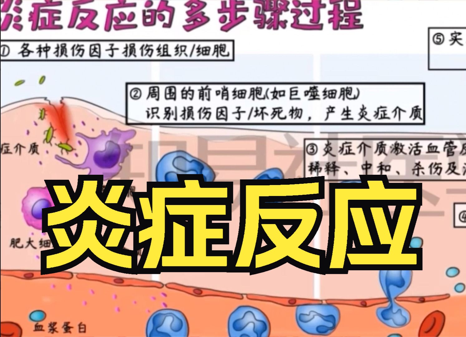 绘画病理学 炎症反应