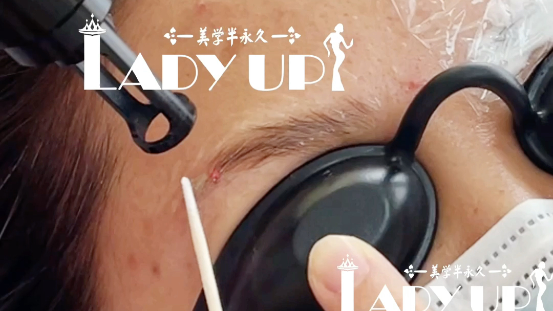 昆明无创洗眉实拍操作过程红眉第一次后对比在最后