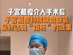 Download Video: 子宫肌瘤介入手术后，肌瘤持续缺血缺氧，最终达到饿死的效果