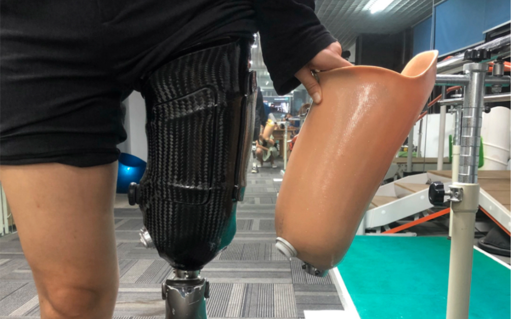 一个舒服的可调松紧碳纤维假肢接受腔