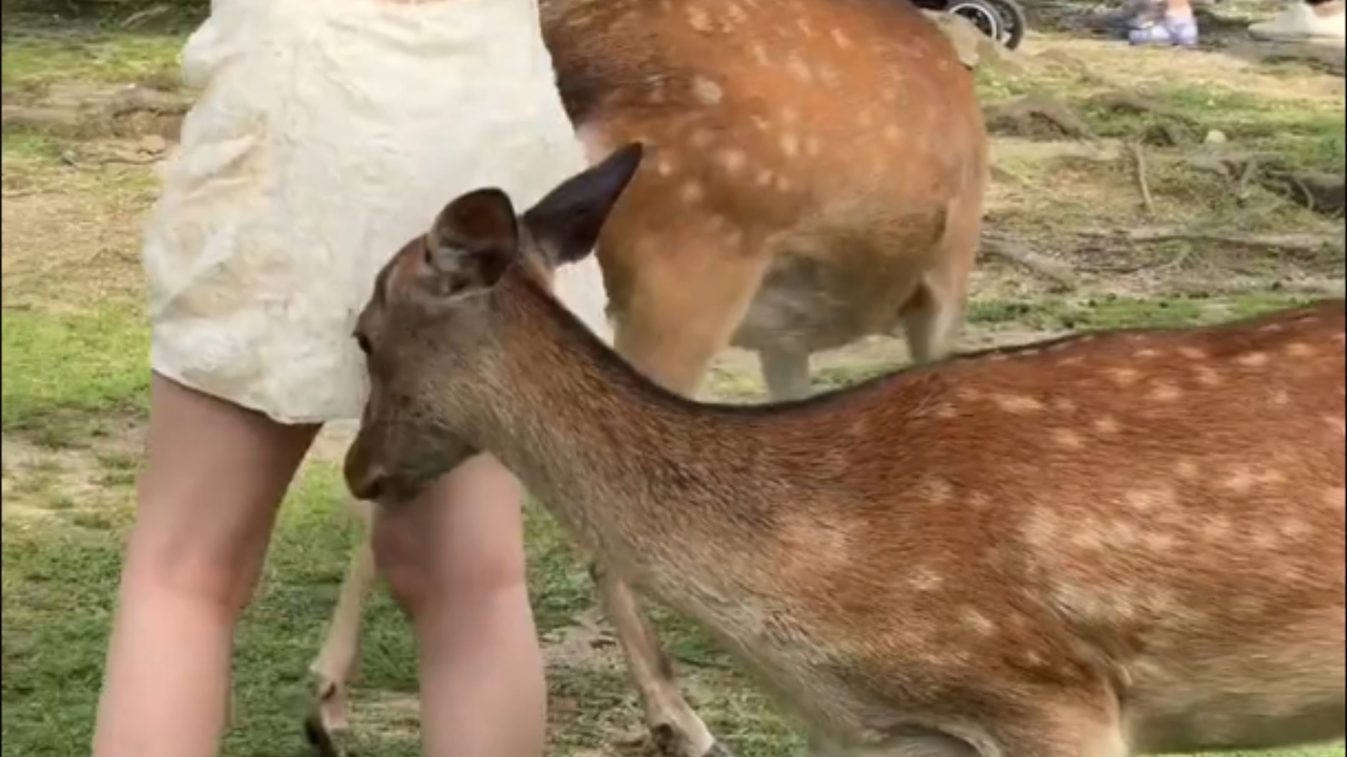 外国唐氏综合症合集03