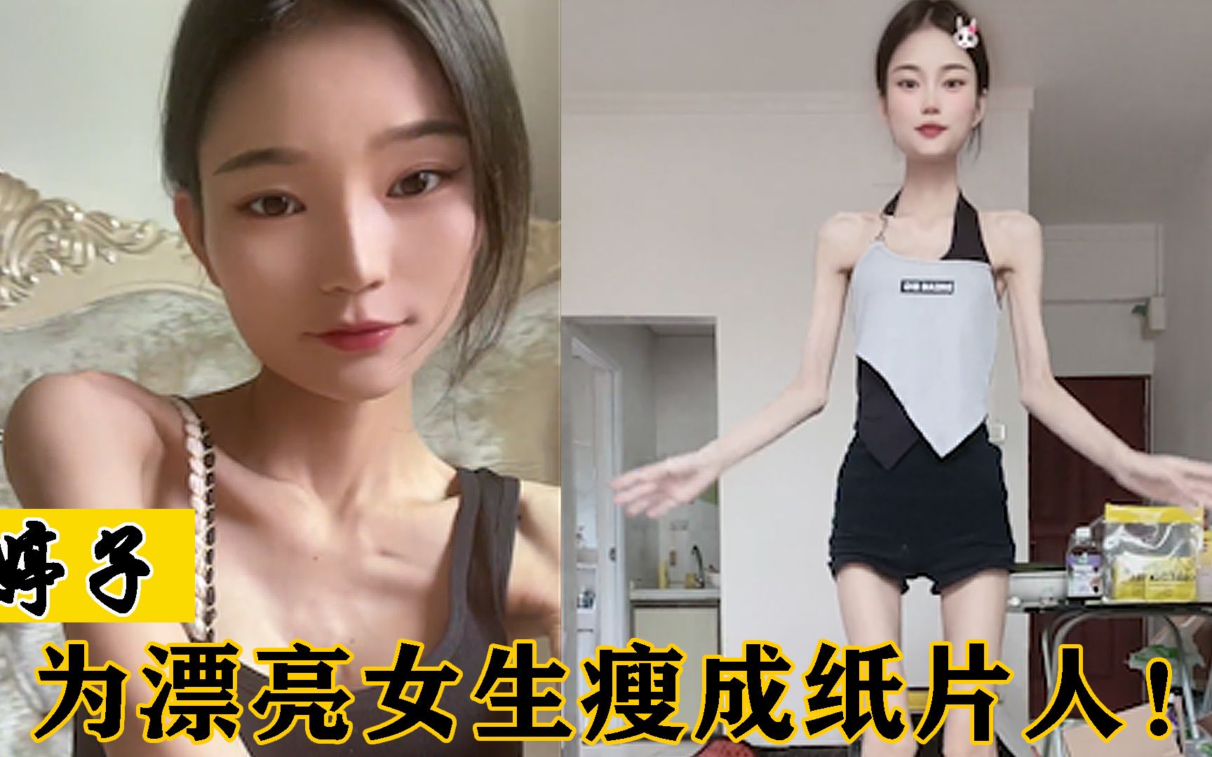 婷子:广东1.6米女生体重仅有60斤,瘦到皮包骨竟还要继续减肥!哔哩哔哩bilibili