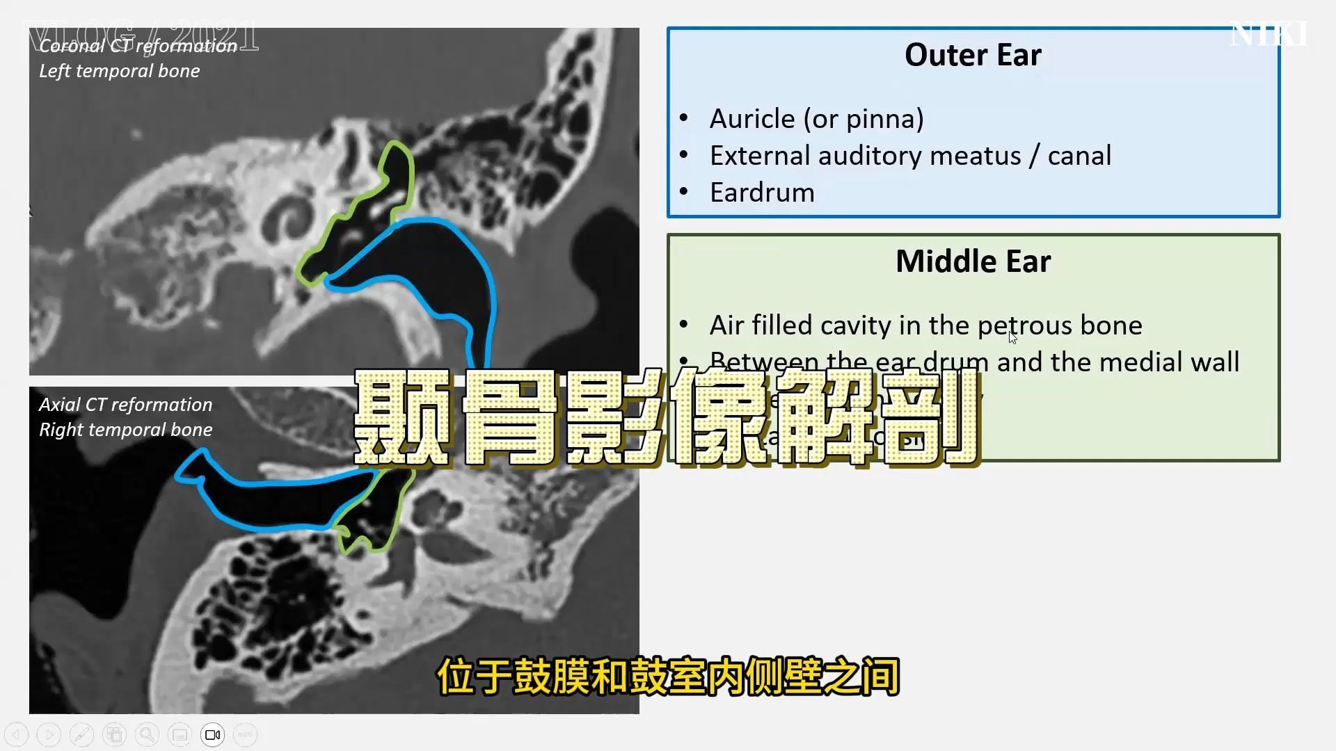 颞骨影像解剖