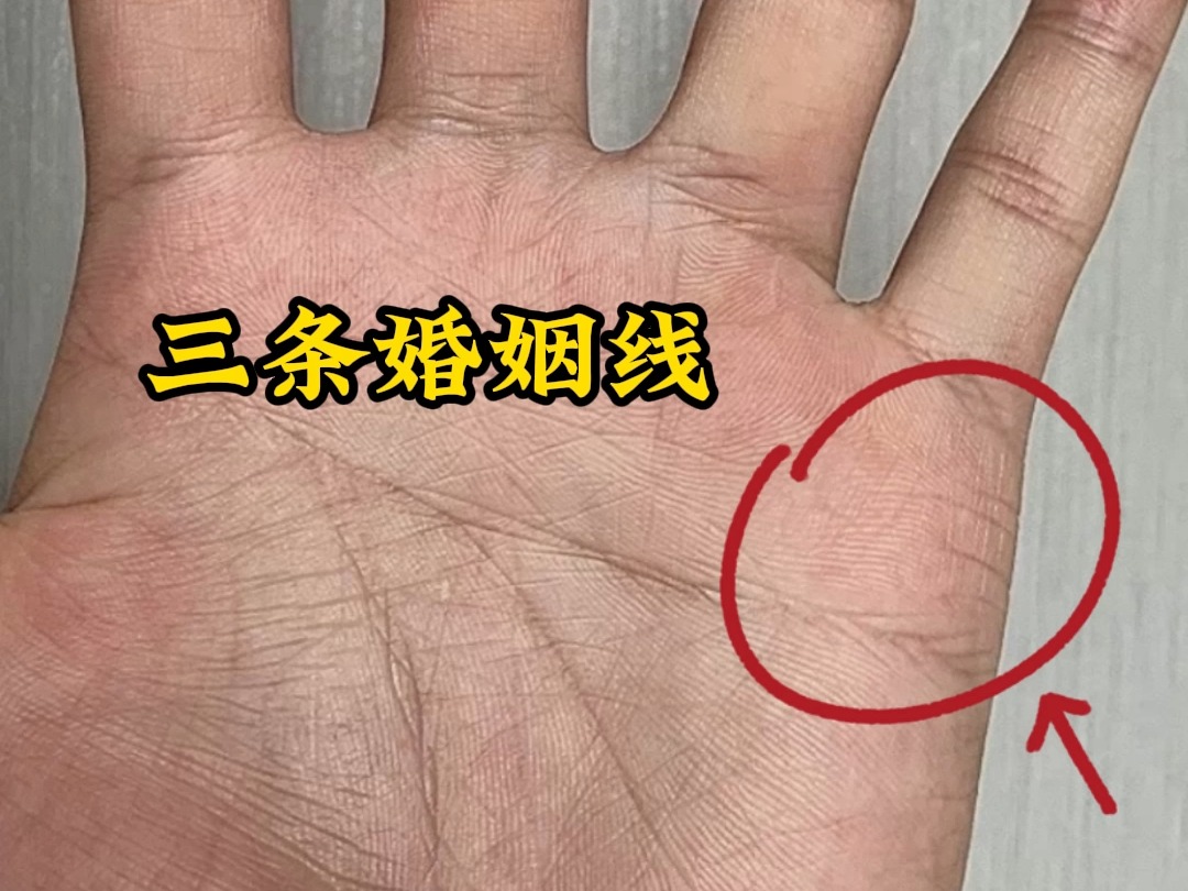 罕见的三条婚姻线