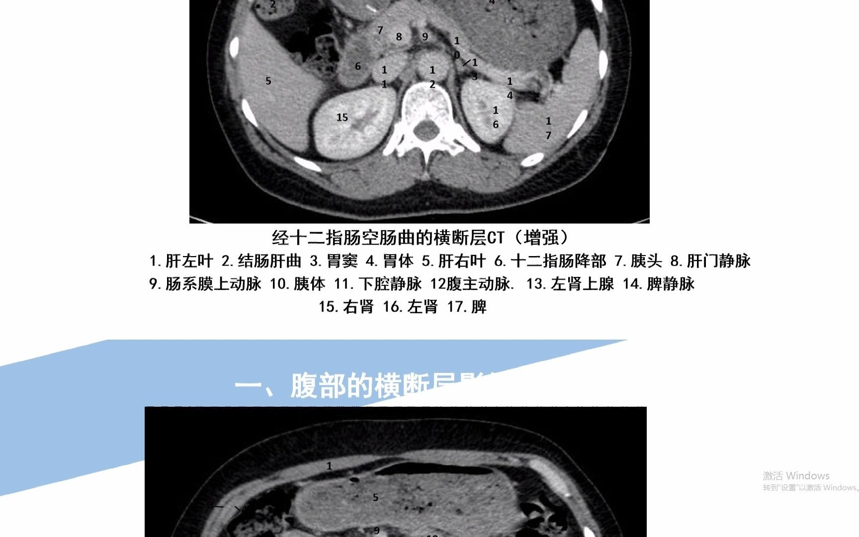 放射医学技术知识点40腹部的断层解剖(七)哔哩哔哩bilibili