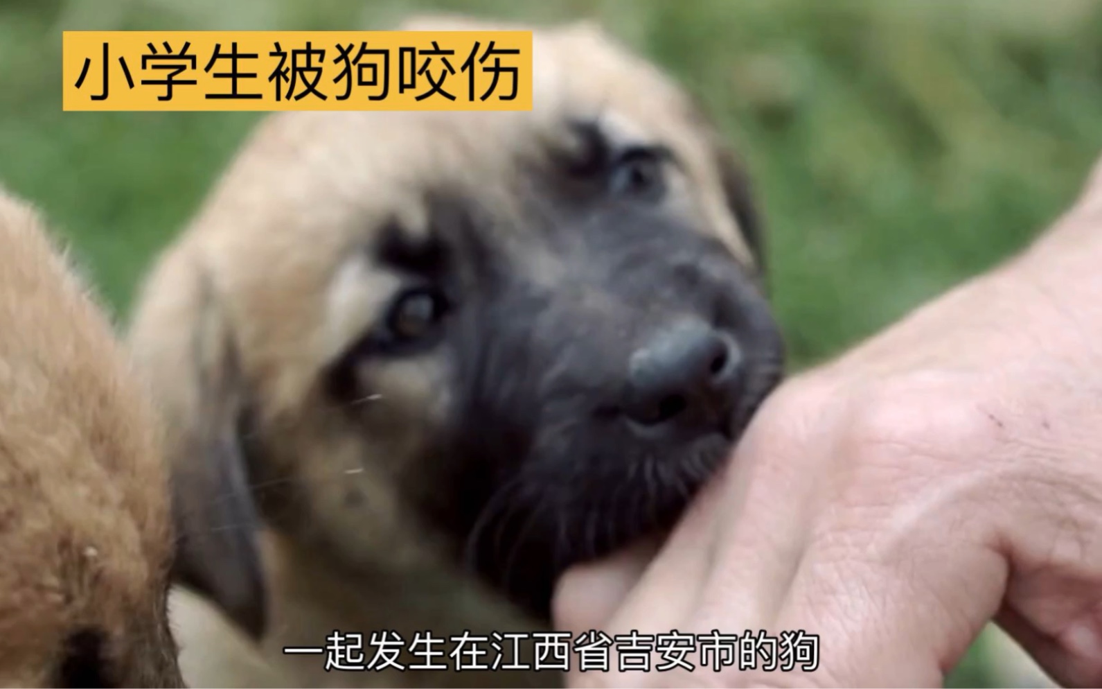 江西吉安狗咬人事件,男童遭狗扑咬,缝了90多针