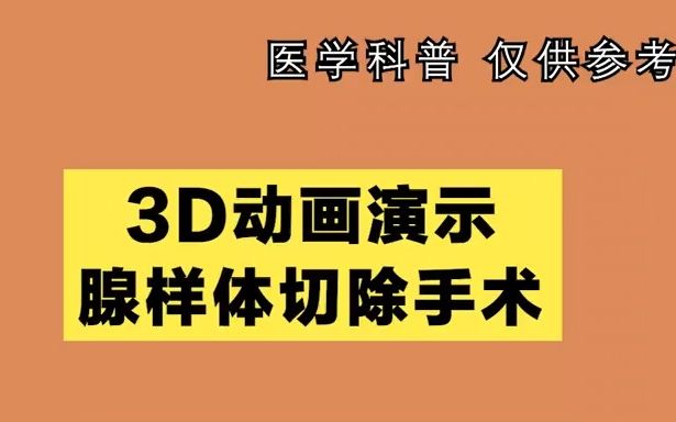 北京首大眼耳鼻喉医院丨3D动画演示腺样体切除手术哔哩哔哩bilibili