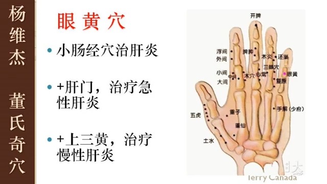 【079】眼黄穴 急慢性肝炎哔哩哔哩bilibili