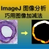 『超实用』ImageJ图像处理 - 巧用图像加减法处理ROI，血管内壁厚度测量