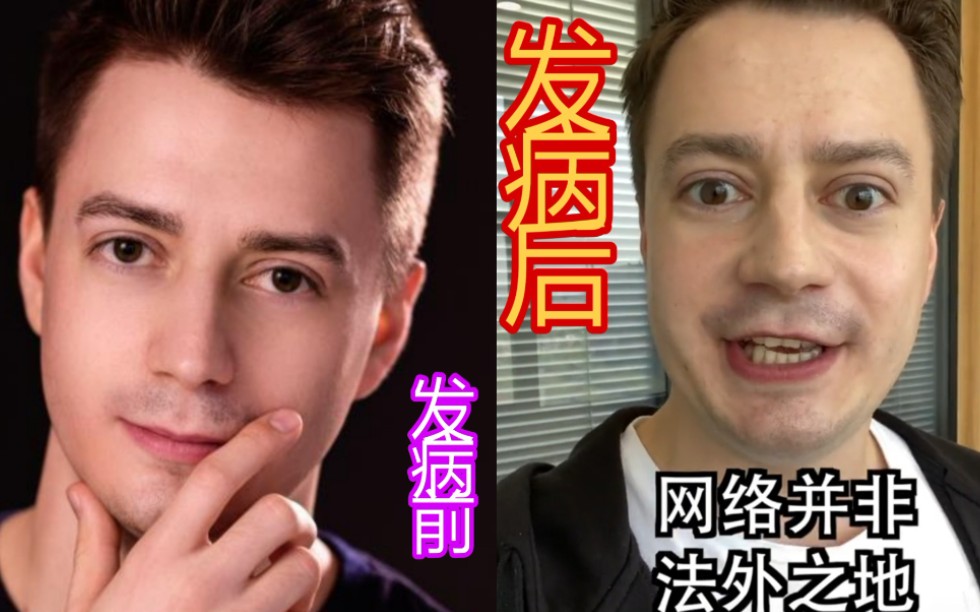 甲亢加重的伏拉夫_哔哩哔哩 (゜-゜)つロ 干杯~-bilibili