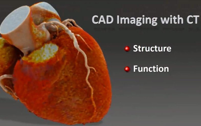 2 Coronary CT Angiography  Joe Schoepf哔哩哔哩bilibili