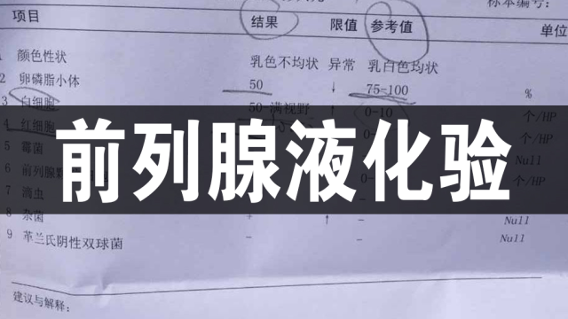 潘氏中医:检查化验前列腺液,对诊断前列腺疾病有什么意义?哔哩哔哩bilibili