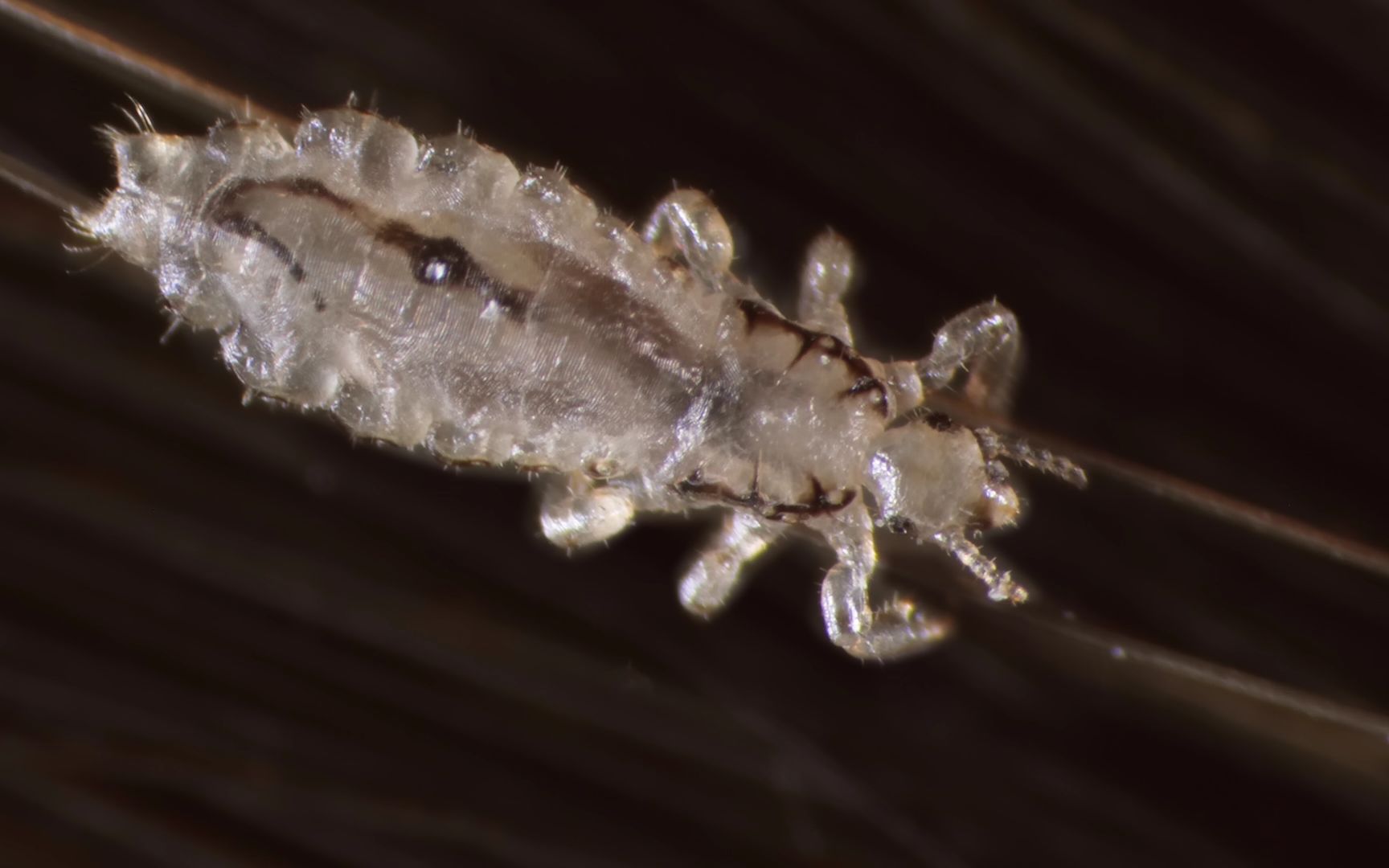 为什么虱子可以在密密麻麻的头发里轻松的活动?