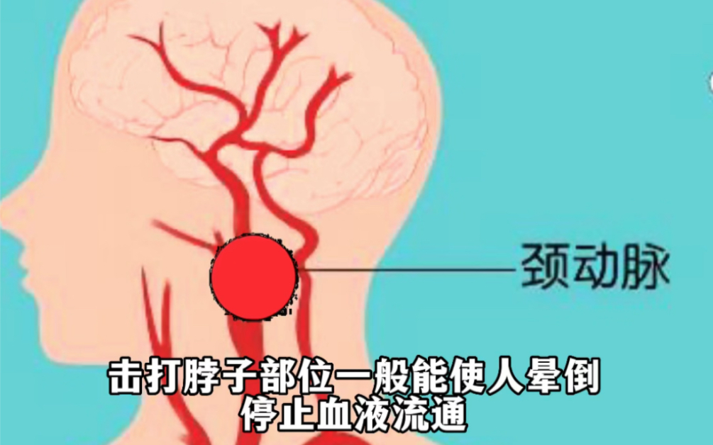 马伽术痛点分布图图片