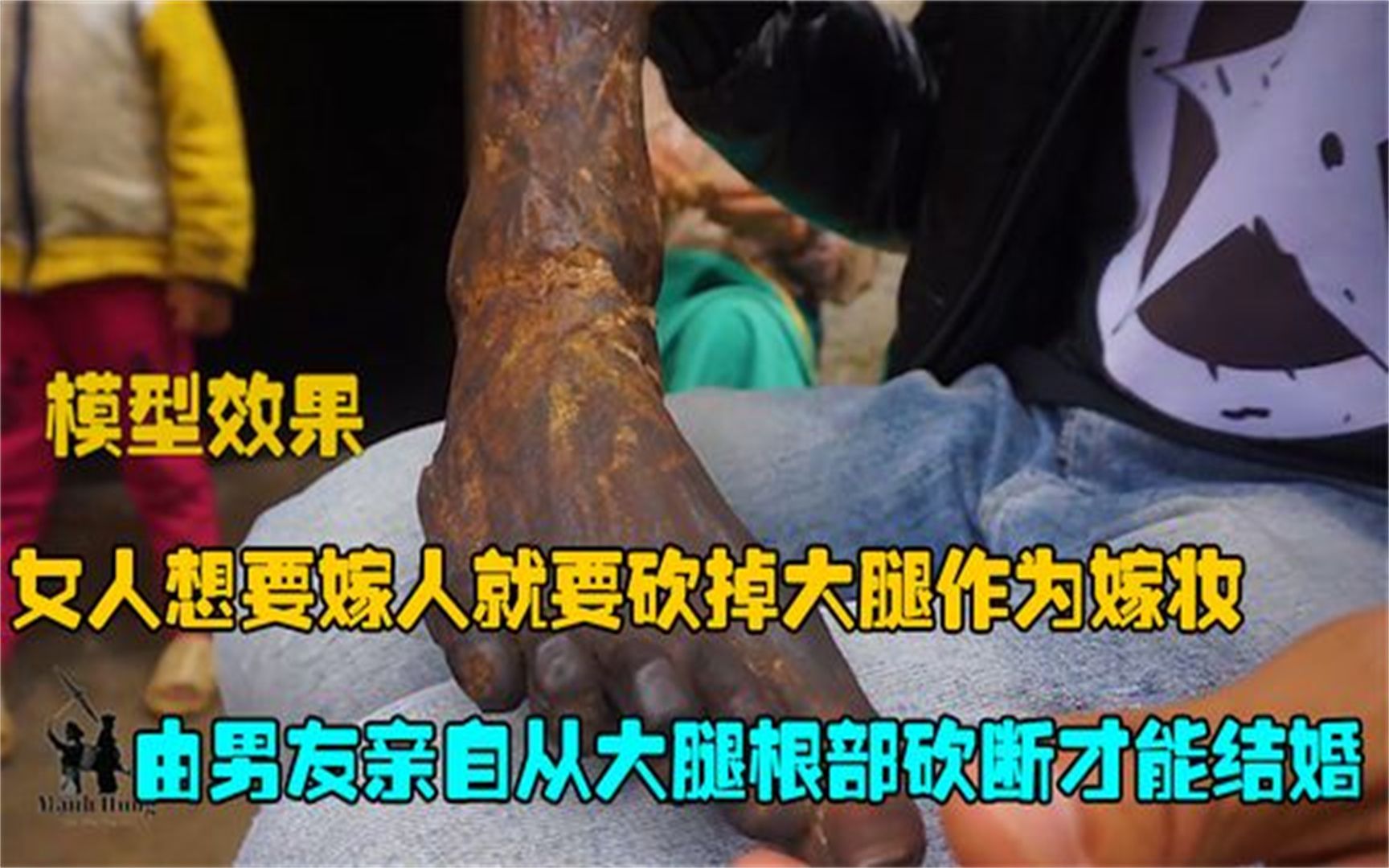 [图]女人想嫁人就要砍掉大腿作为嫁妆，由男友从根部砍断才能结婚