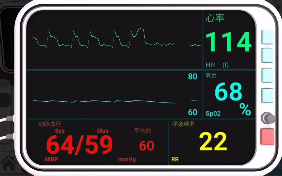 [图]《真实医疗模拟器》这个心梗病人也是真顽固