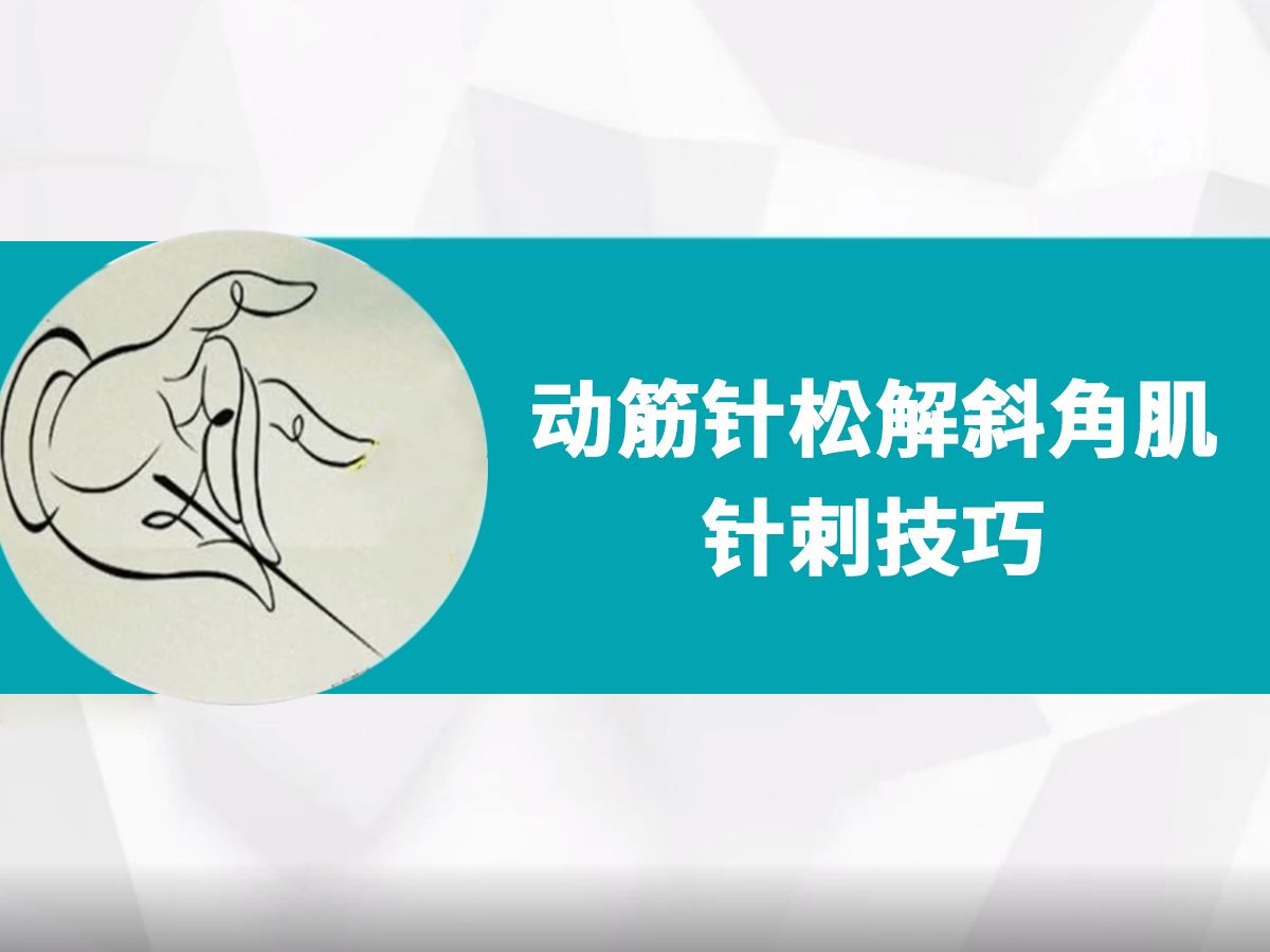 三甲医院针灸师分享松解斜角肌的针刺技巧,安全、有效,立竿见影(海外名家:陈德成及其团队)哔哩哔哩bilibili