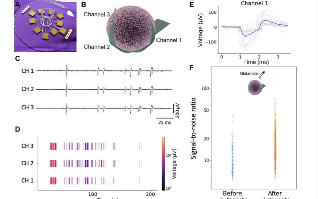 最小3D帽微电极阵列文献讲解 大狗宝文献分享 Shell microelectrode arrays (MEAs) for brain organoids哔哩哔哩bilibili