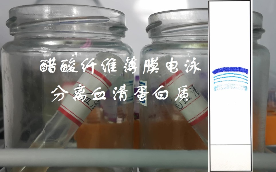 [图]【天青夏妖】醋酸纤维薄膜电泳分离血清蛋白质