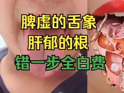 Video herunterladen: 脾虚的舌象，肝郁的根，走错一步全白搭