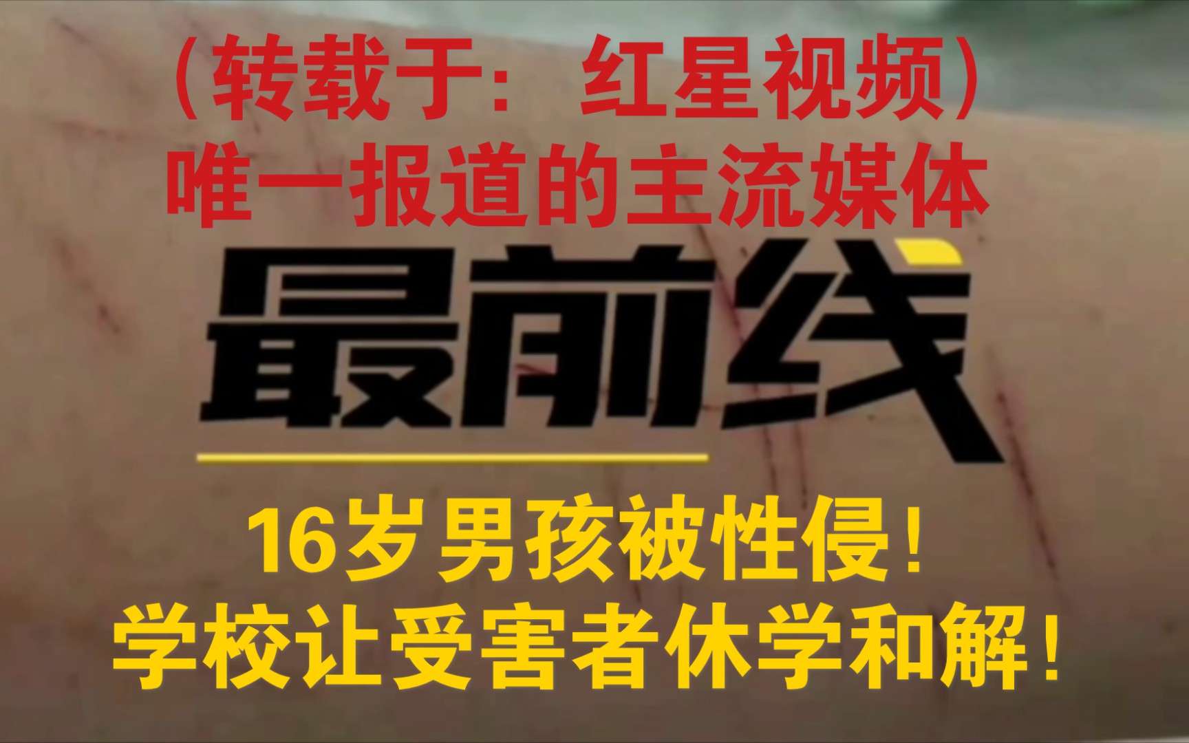 【校园霸凌】北京16岁男生因取向被同学霸凌性侵,学校让受害者休学和解!(转载红星视频)哔哩哔哩bilibili