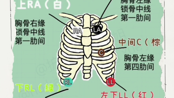 心电监护要记住,黑白红绿棕哔哩哔哩bilibili